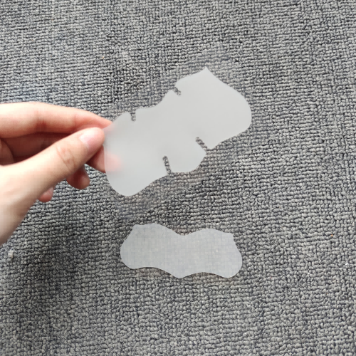 鼻ストリップの黒ずみ除去